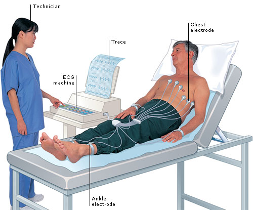 Diagnosis Blok Cabang Bundel Kanan elektrokardiogram untuk